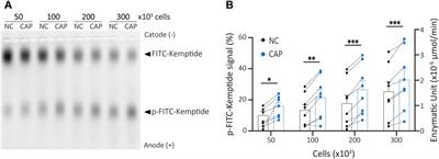 A versatile kinase mobility shift assay (KiMSA) for PKA analysis and cyclic AMP detection in sperm physiology (and beyond)